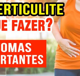 DIVERTICULITE - Sintomas e O QUE FAZER