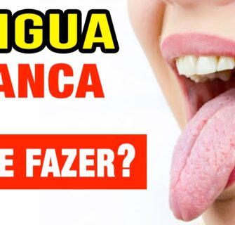 Já teve LINGUA BRANCA? Causas e O QUE FAZER!