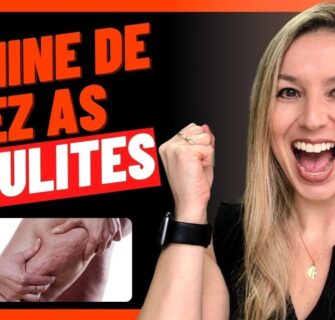 📣 COMO ACABAR COM AS CELULITES DE VEZ / 7 Dicas para você Eliminar as Celulites