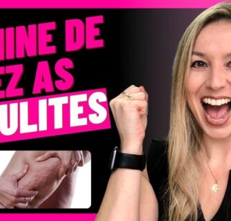 COMO ACABAR COM A CELULITE / 7 Dicas para você Eliminar de Vez as Celulites