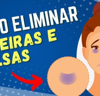 Como Se Livrar de OLHEIRAS, BOLSAS NOS OLHOS e INCHAÇO!