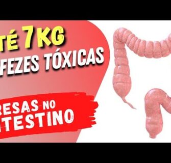 Até 7 KG DE FEZES Tóxicas PRESAS no INTESTINO? Veja Isso!