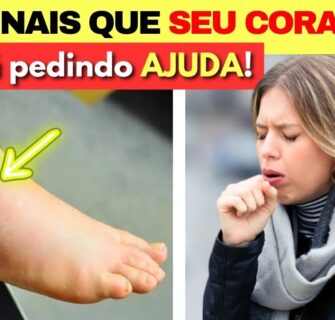 10 SINAIS que seu CORAÇÃO ESTÁ PEDINDO AJUDA! O Que Fazer? Insuficiência Cardíaca?