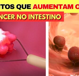 7 Hábitos que AUMENTAM O RISCO de CÂNCER DE INTESTINO! Cuidado, mude isso hoje mesmo!