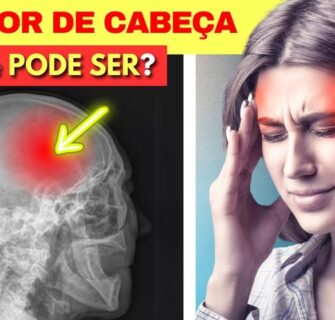 O Que Pode Ser sua DOR DE CABEÇA? Veja O QUE FAZER em Cada Caso!