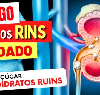 PERIGO PARA OS RINS - Cuidado com AÇÚCAR e CARBOIDRATOS RUINS! Dicas Importantes e Alternativas