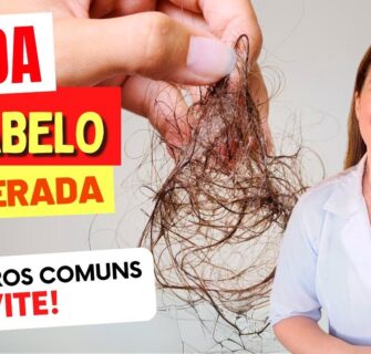 10 Coisas que ACELERAM A QUEDA DE CABELO e A MAIORIA NÃO SABE!