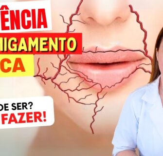 DORMÊNCIA e FORMIGAMENTO NA BOCA - O Que Pode Ser? O Que Fazer?