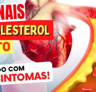 8 SINAIS de COLESTEROL ALTO - Cuidado com estes Sintomas!