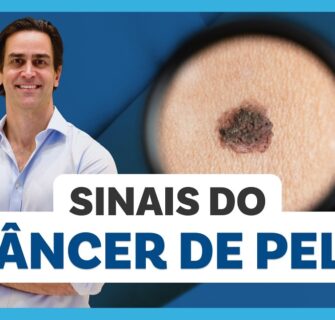 CÂNCER DE PELE: tipos, sinais, tratamento e como prevenir