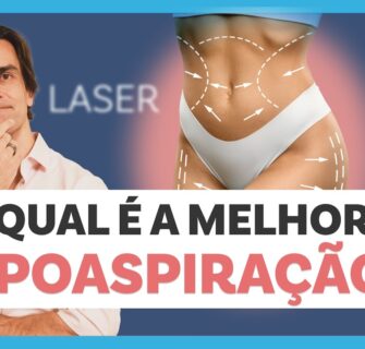 LIPOASPIRAÇÃO: como é feita, tipos e recuperação