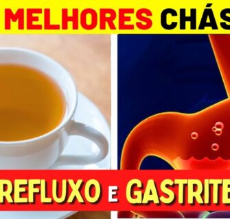 5 Melhores CHÁS para GASTRITE e REFLUXO - Benefícios, Como Preparar e Como Tomar