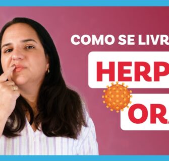 HERPES ORAL: Sintomas, Causas e Tratamentos!