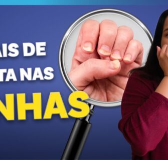 10 Alterações nas Unhas Que Indicam Problemas de Saúde