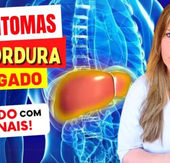 10 SINAIS DE ALERTA para GORDURA NO FÍGADO - Cuidado com estes SINTOMAS!
