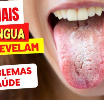 Sua LÍNGUA Está ASSIM? O Que Isso Diz Sobre Sua Saúde - 6 SINAIS ESTRANHOS que Você NÃO DEVE IGNORAR